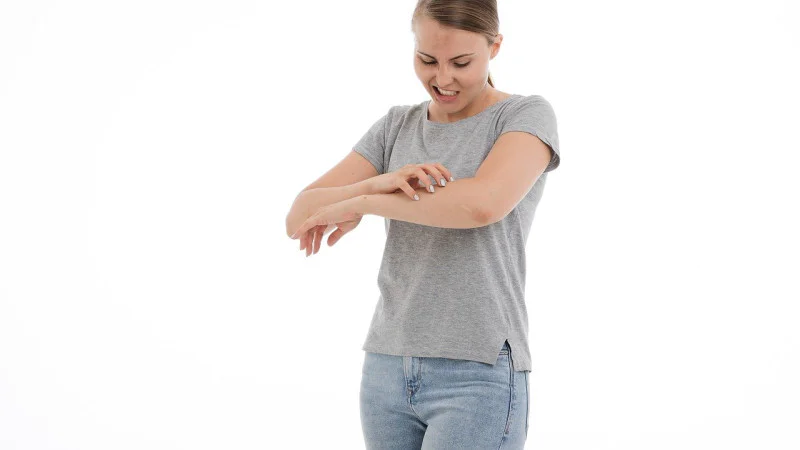Homeopathic Medicine For Hives Homeopathic Medicine For Hives