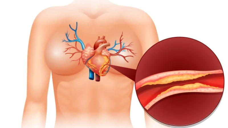 Homeopathy Medicine For Cholesterol