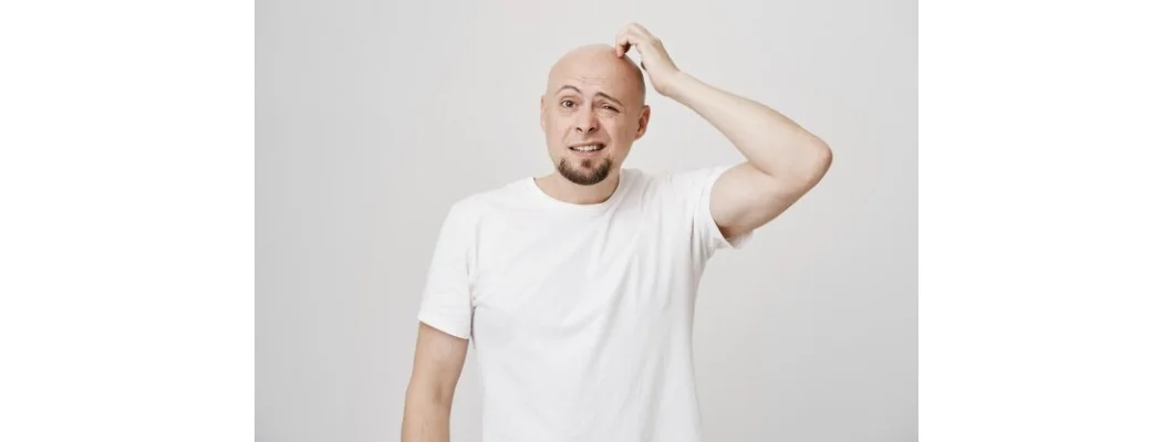The Best Homeopathic Treatments for Baldness