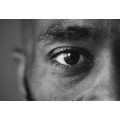 Homeopathic Medicine for Glaucoma