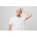 Homeopathic Medicine for Alopecia & Bald Patches