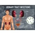 Homeopathic Medicine for Urinary Tract Infection