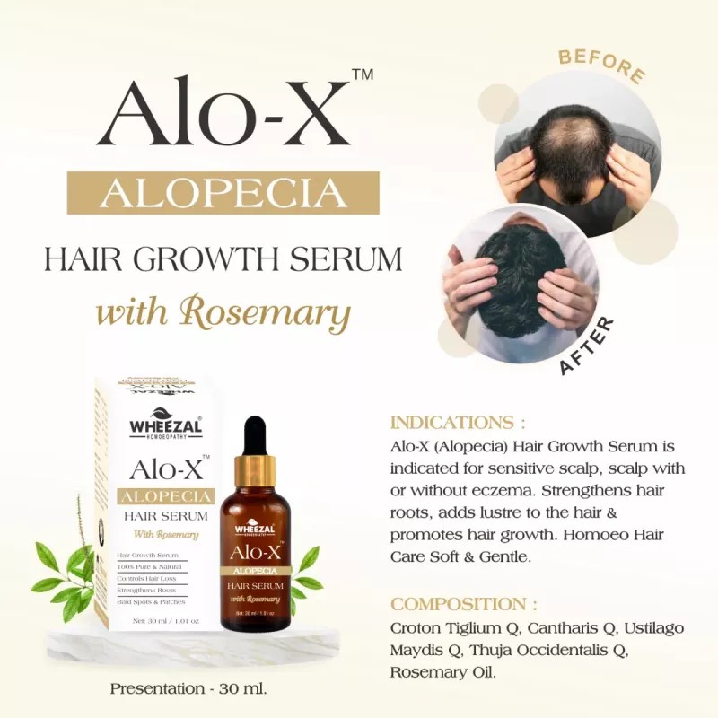 Wheezal Alo-X Alopecia Hair Serum (30ml)