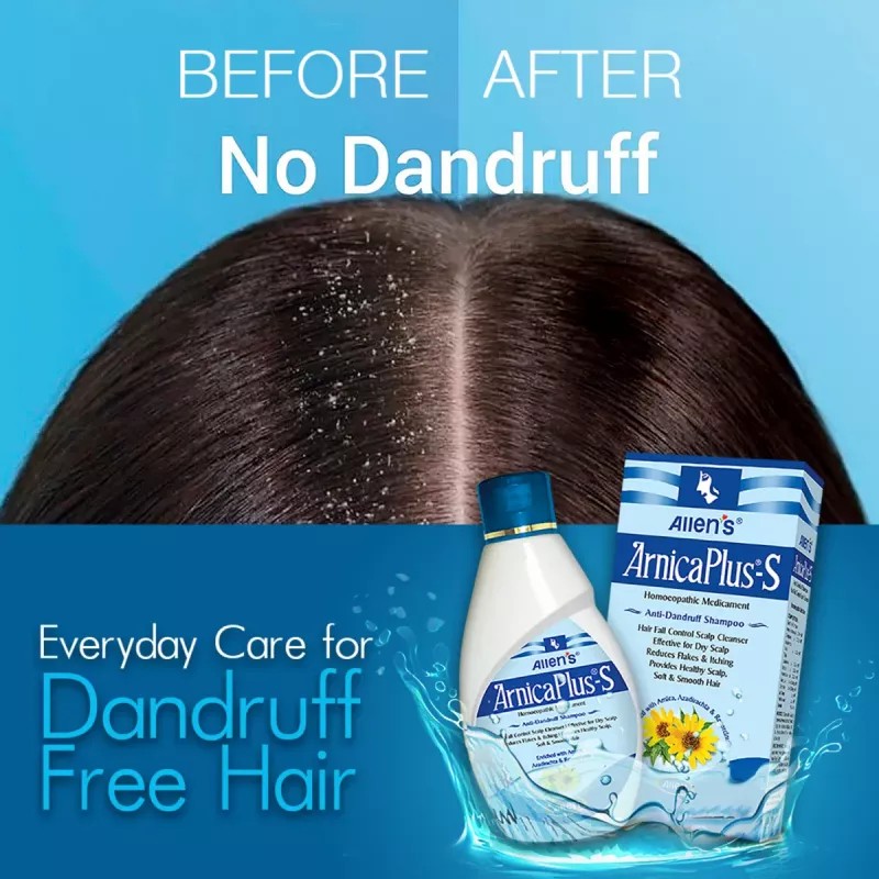 Allen Labs Arnica Plus S - Anti Dandruff Shampoo (100ml, Pack of 2)