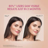 Dr Reddy Depiwhite Advanced Cream (40ml)