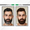 Nisha Beard Cream Color For Men 104 Natural Brown (Developer 20g + Colorant 20ml) (40g)