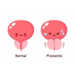 <h2>Prostate Enlargement</h2>