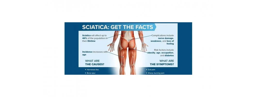 What is Homeopathic Medicine for Sciatica Pain Relief?