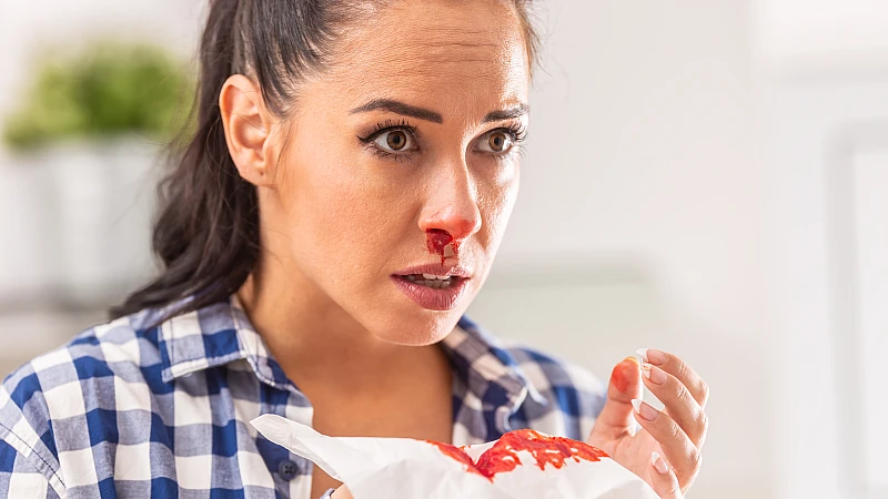 Homeopathic Treatment for Nose Bleeding Homeopathic Treatment for Nose Bleeding