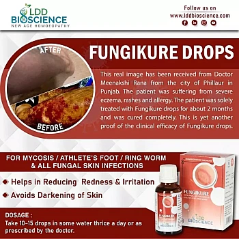 LDD Bioscience Fungikure Drops (30ml)