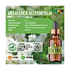 Organix Mantra Aaa Australian Tea Tree Essential Oil (15ml)