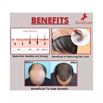 Zenius India Hair Oil (200ml)