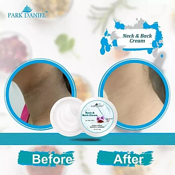 Park Daniel Neck & Back Cream (100g, Pack of 2)