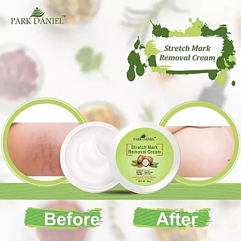 Park Daniel Stretch Mark Removal Cream (100g, Pack of 2)