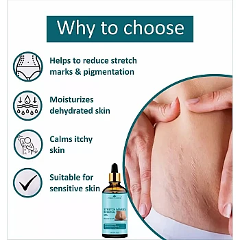 Park Daniel Stretch Marks Removal Oil (30ml)