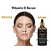 Park Daniel Advance Hair Growth Serum + Vitamin C20% Facial Serum (30ml Each) (1Pack)