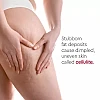 VLCC Clinic Prosculpt Cellulite Reduction Gel (90g)