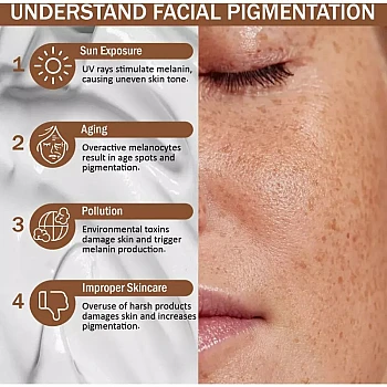 7Days Natural Good Bye Pigmentation Cream (100g)