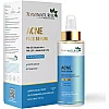 7Days Natural Acne Face Serum (30ml)