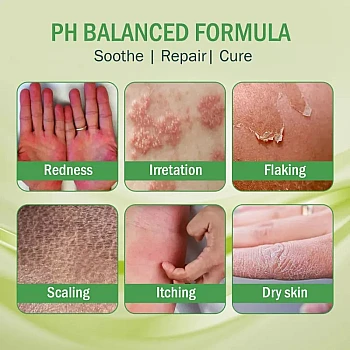 7Days Natural Itch Kure Cream (30g)