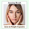 Cipzer Acne & Pimple (60cap, Pack of 2)