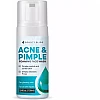 Bounty Bliss Acne & Pimple Foaming Face Wash (100ml)