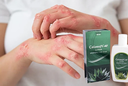 Calosoft AF Lotion: A Comprehensive Guide to Ingredients, Benefits, and Uses
