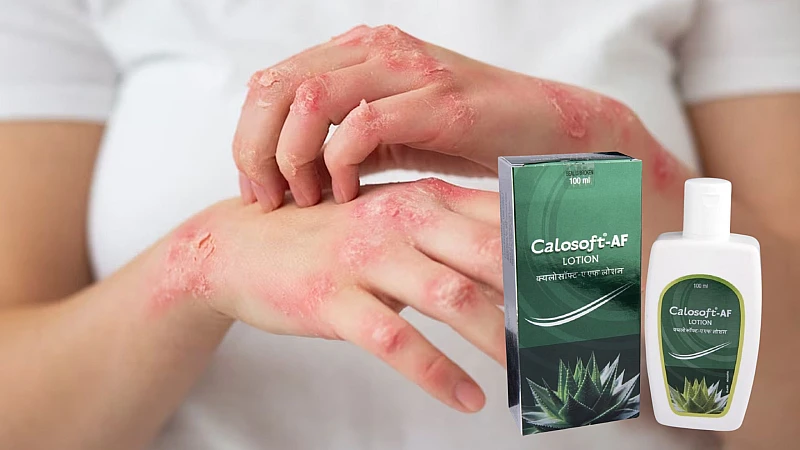 Calosoft AF Lotion: A Comprehensive Guide to Ingredients, Benefits, and Uses Calosoft AF Lotion: A Comprehensive Guide to Ingredients, Benefits, and Uses