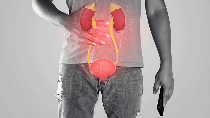 Top 5 Homeopathy Medicines For Kidney Stone Treatment