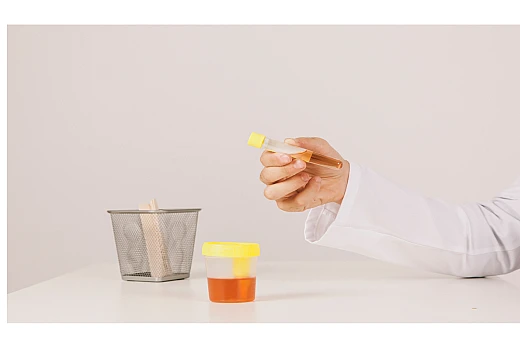 What is Homeopathic Medicine for Haematuria?