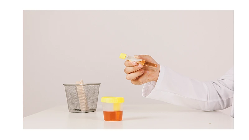 What is Homeopathic Medicine for Haematuria? What is Homeopathic Medicine for Haematuria?