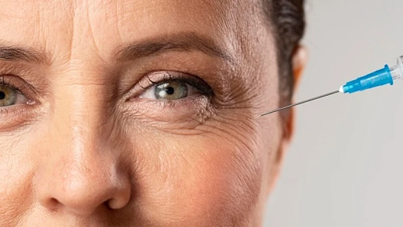 Wrinkles can be treated with homeopathy