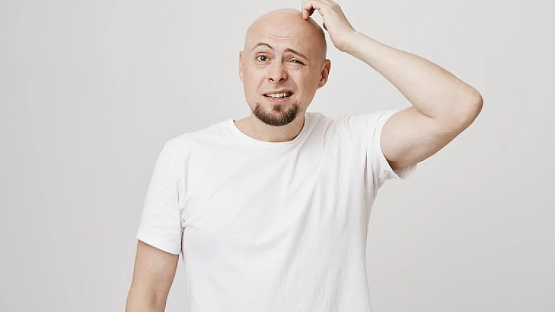 The Best Homeopathic Treatments for Baldness The Best Homeopathic Treatments for Baldness