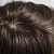 Homeopathic Medicine for Dandruff