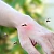 Homeopathic Medicine for Malaria Homeopathic Medicine for Malaria