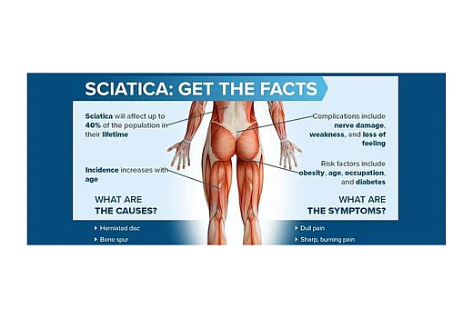 What is Homeopathic Medicine for Sciatica Pain Relief?