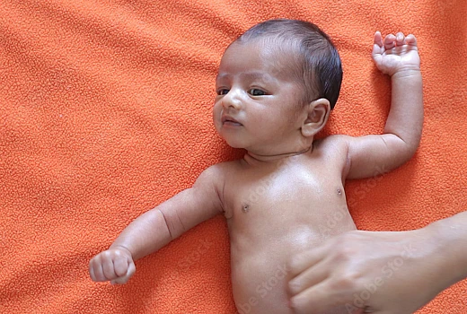 Homeopathy Medicine For Marasmus