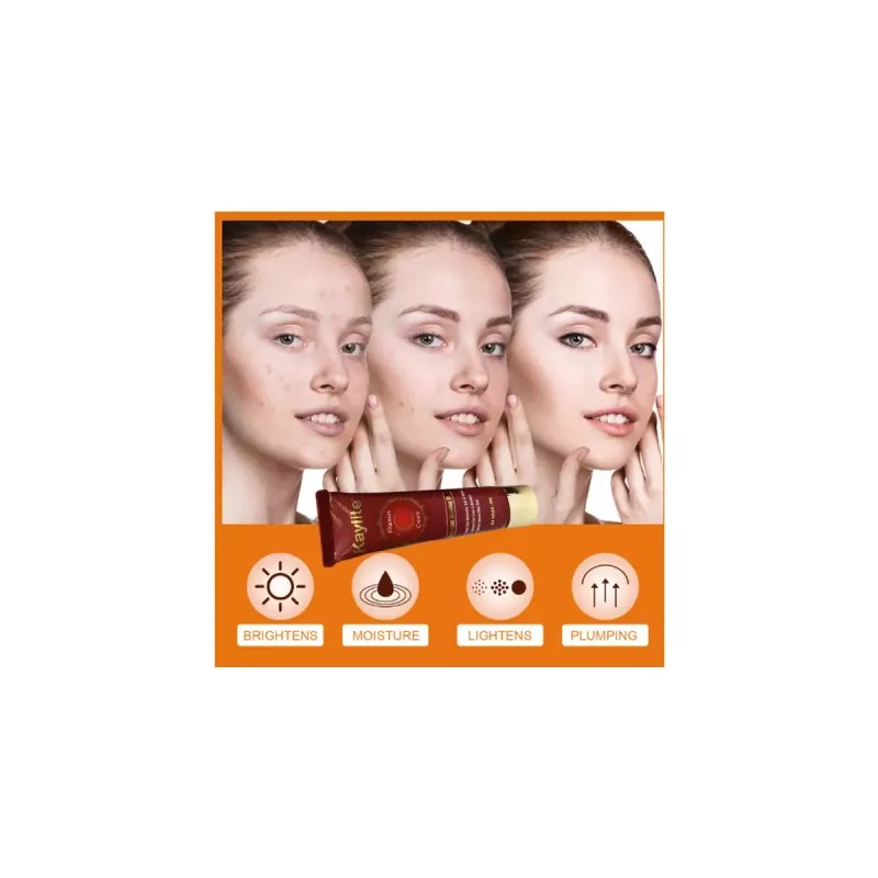 Kaylite Vitamin C Cream (30g, Pack of 3)