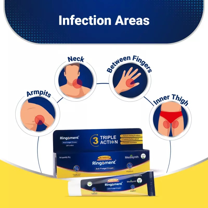 Medisynth Ringoment Anitfungal Cream (20g)