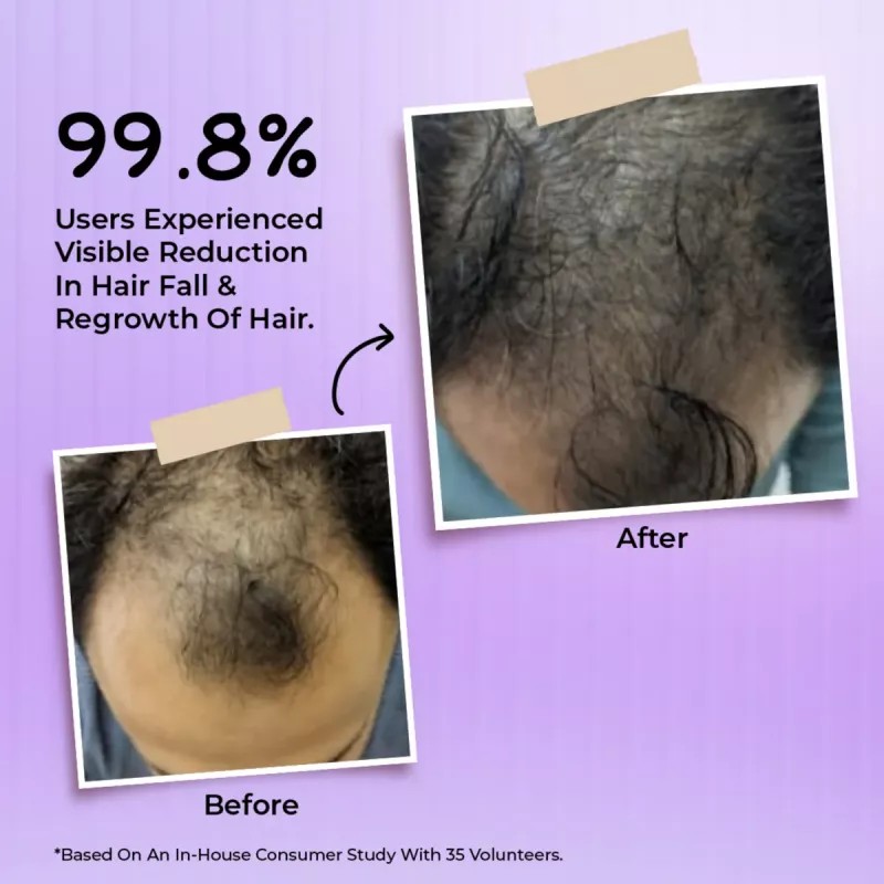 Bakson Hair Reviver (100ml)