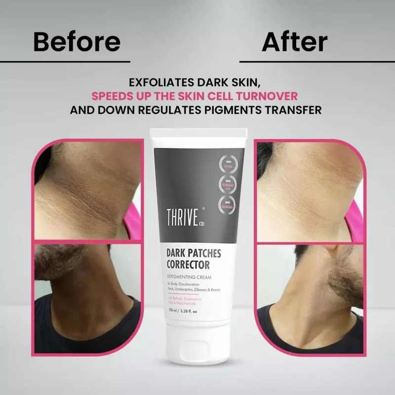 ThriveCo Dark Patches Corrector (100ml)