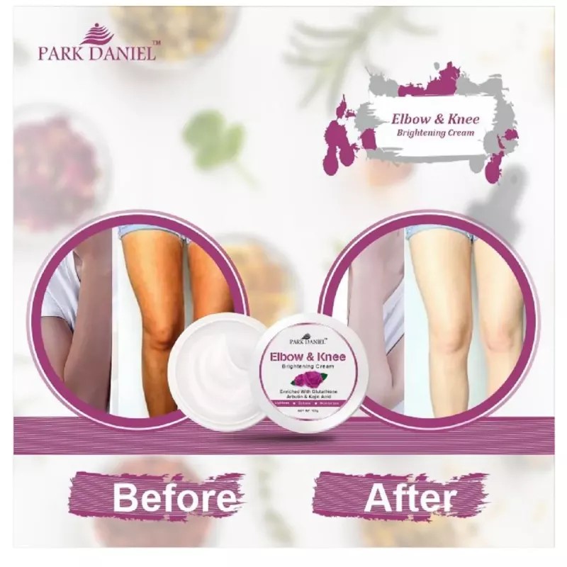 Park Daniel Elbow & Knee Brightening Cream (100g, Pack of 3)