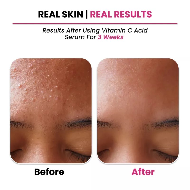 ThriveCo 10% Vitamin C+ Hyaluronic Acid Serum (30ml)