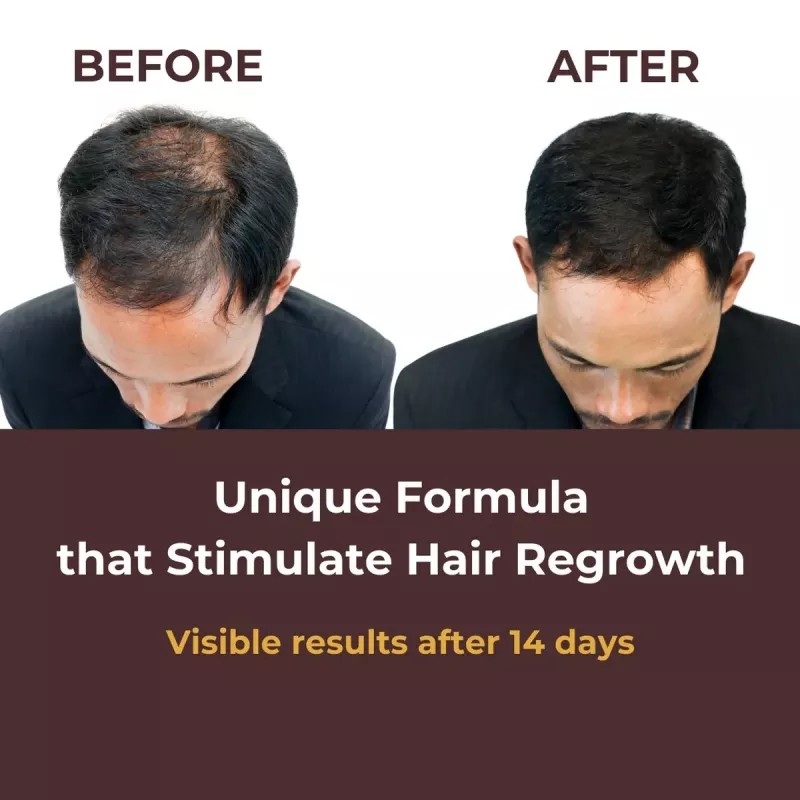 Prisa Organics Hair Regrowth Serum (50ml)