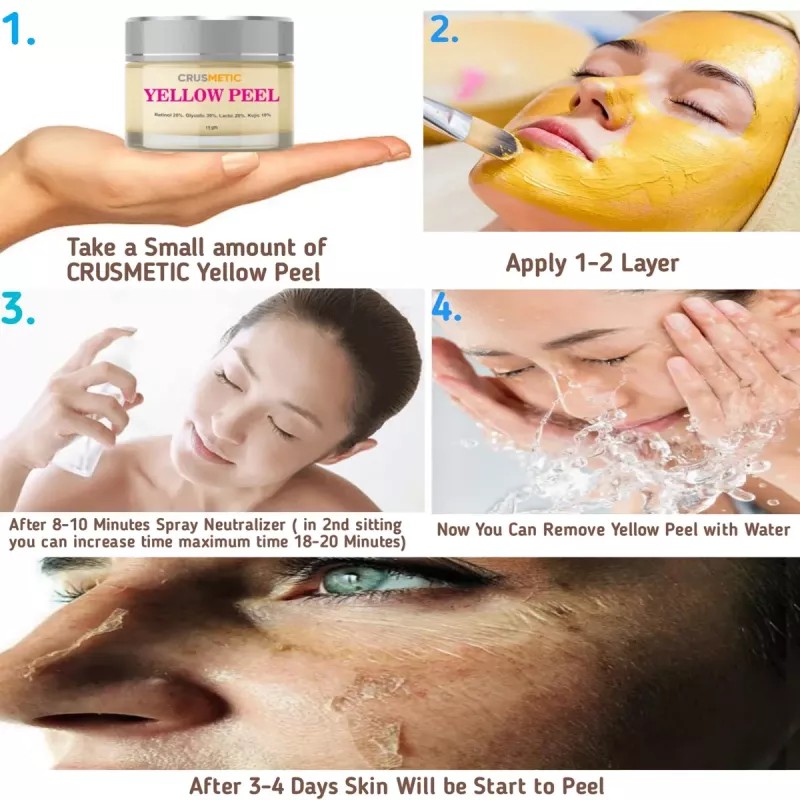 Crusmetic Yellow Peel + Neutralizer Solution + Disifected Cotton Swab Stick (15gm + 30ml + 4pcs Stick) (1Pack)