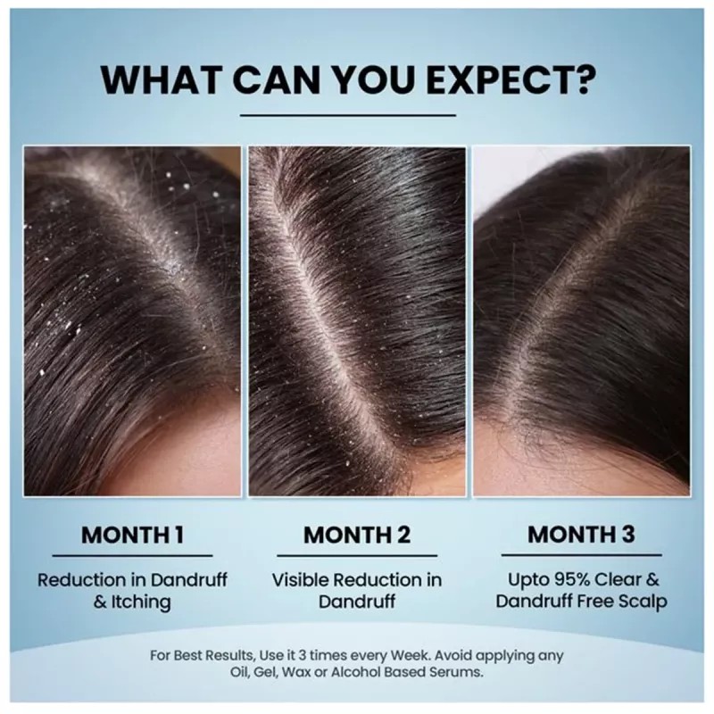 Lio Cosmeds Ph Glo Anti Dandruff Shampoo With Conditioner (100ml)