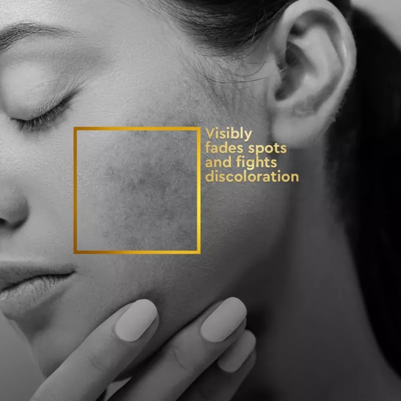 VLCC Clinic Properfect Spot Clarifying Face Wash (150ml)