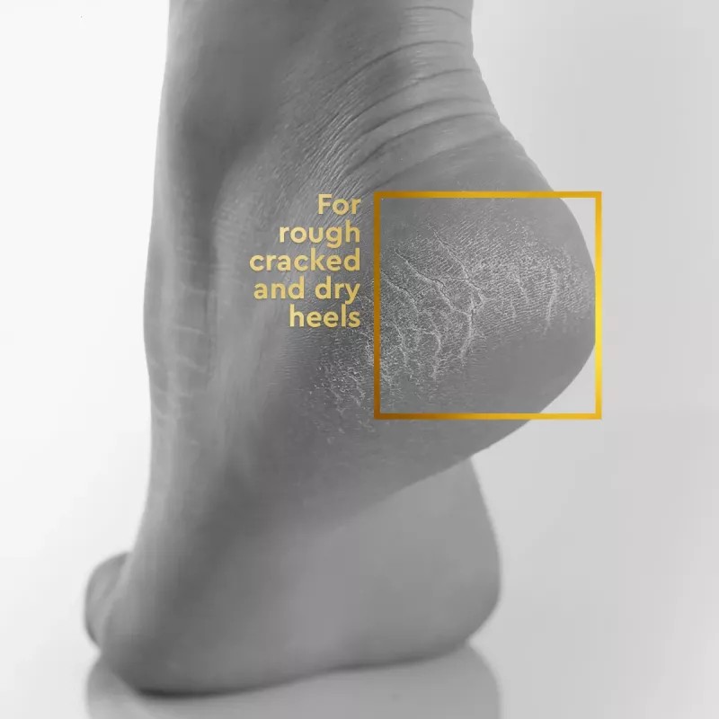 VLCC Clinic Heel Repair Cream (100g)