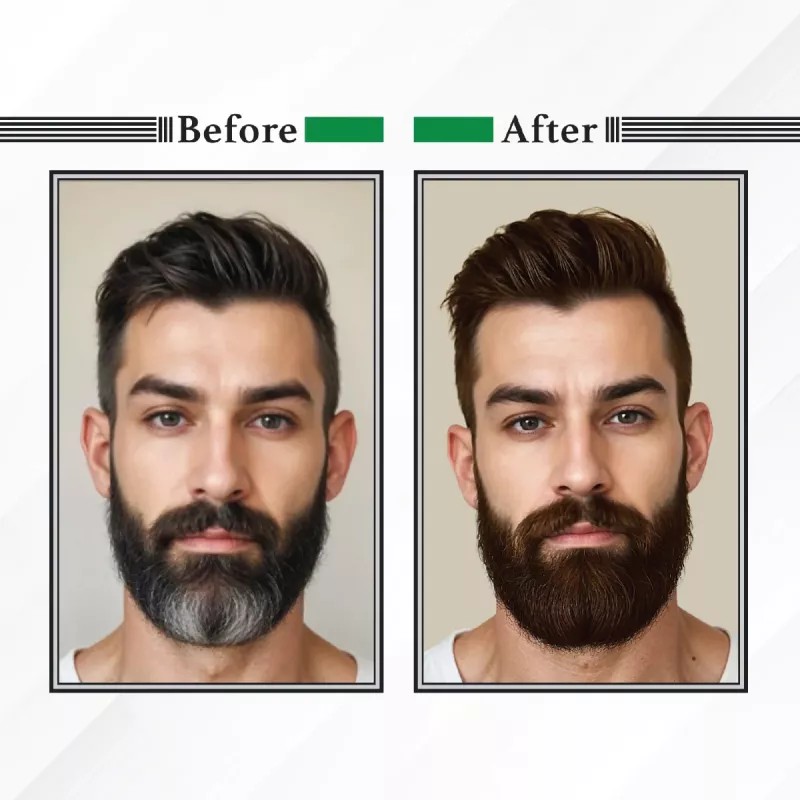 Nisha Beard Cream Color For Men 104 Natural Brown (Developer 20g + Colorant 20ml) (40g)