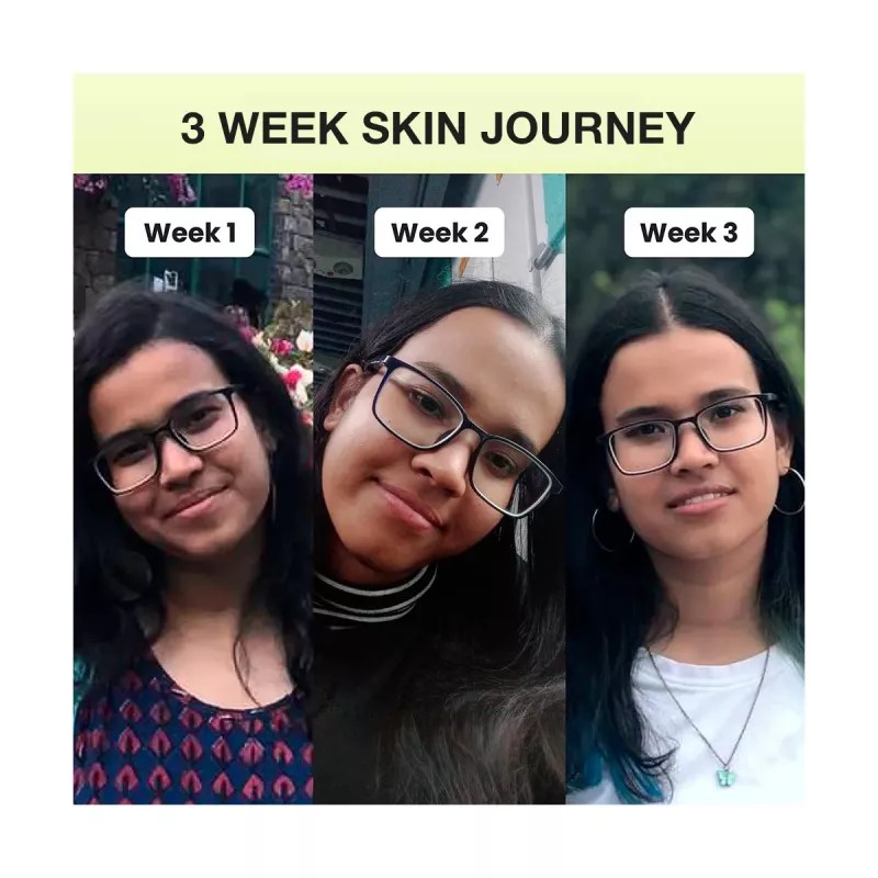 COSIQ Vitamin B3 20% Niacinamide Face Serum (30ml)